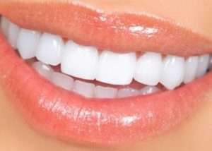 Диоксид циркония в стоматологии: коронки, зубы, отзывы, фото до и после