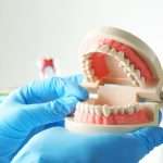 Зубной налет: виды, причины образования и способы удаления