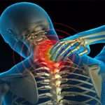 Шейный остеохондроз: симптомы, причины, варианты лечения, лечебная гимнастика, массаж, отзывы