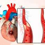 Атеросклеротический кардиосклероз: причины, симптомы и лечение