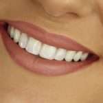 Дистопированный зуб: причины, симптомы, диагностика и лечение