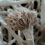 Строение микроскопических грибов: особенности